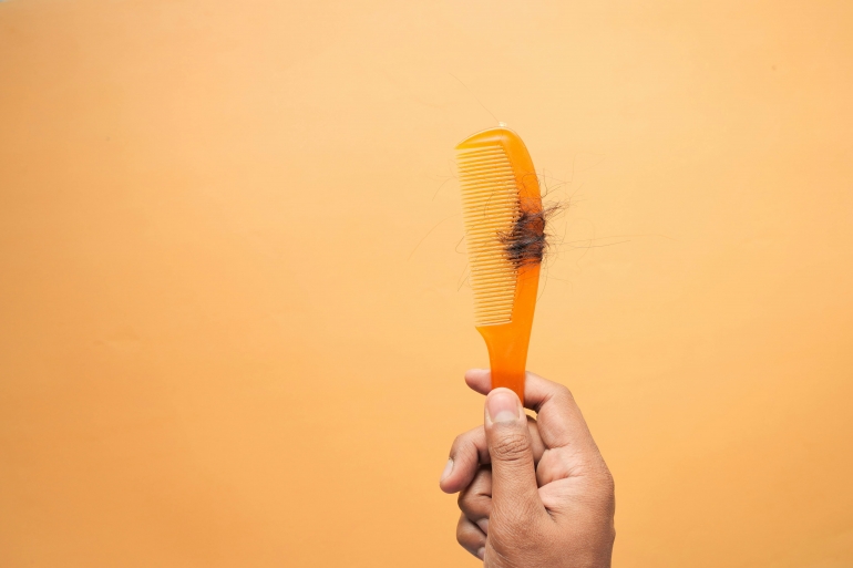 Chute de cheveux et changement de saison : préparez-vous pour l’automne sans perdre vos cheveux ! ?